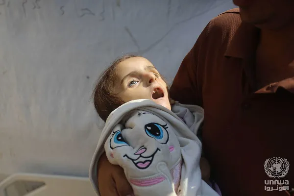 A 4-year-old Palestinian girl, lost her life due to malnutrition and lack of treatment due to the war on Gaza